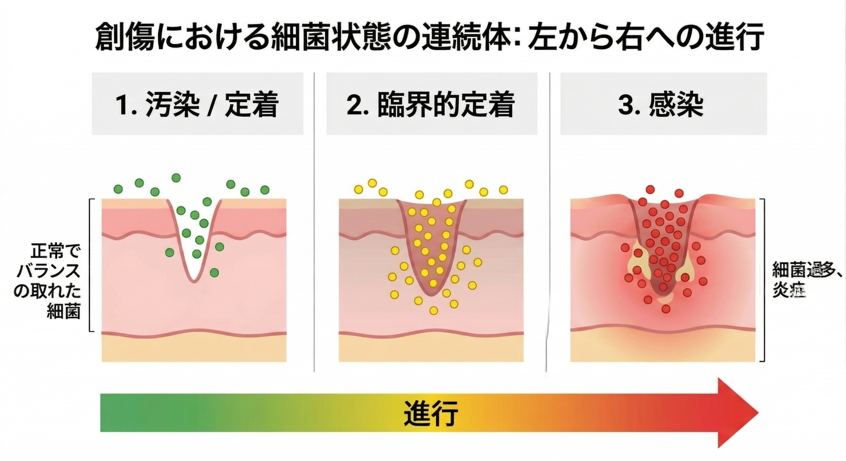 感染・臨界的定着・定着の違いを示す概念図